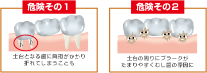 �댯����1��2